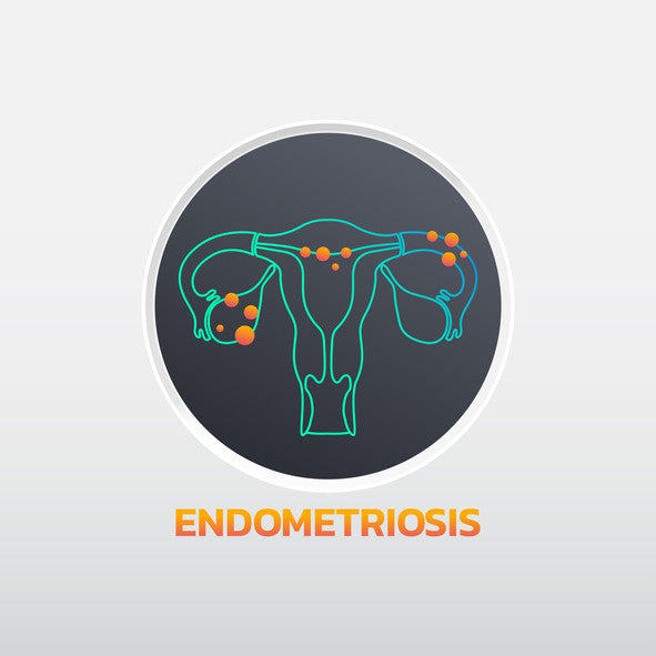 Treating the pain of endometriosis
