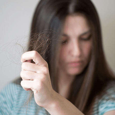 Hair Loss in Women: Causes, Prevention & Home Remedies