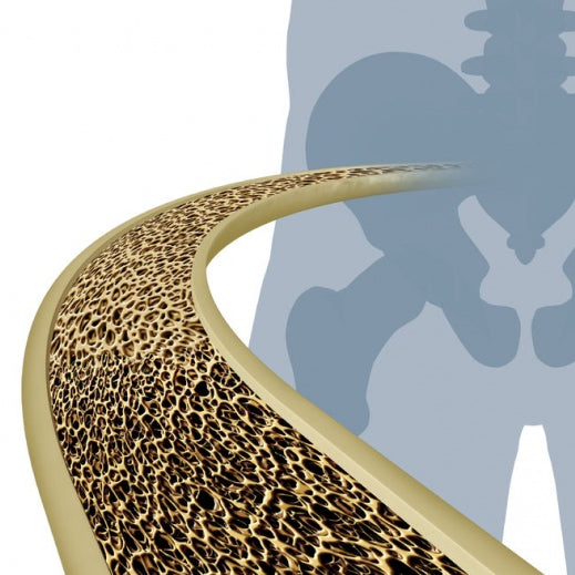 Osteoporosis Causes, Risk Factors, Complications, Diagnosis and Treatment